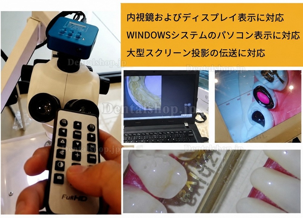 歯科手術用根管治療顕微鏡 カメラ付き デンタルチェアーに適用